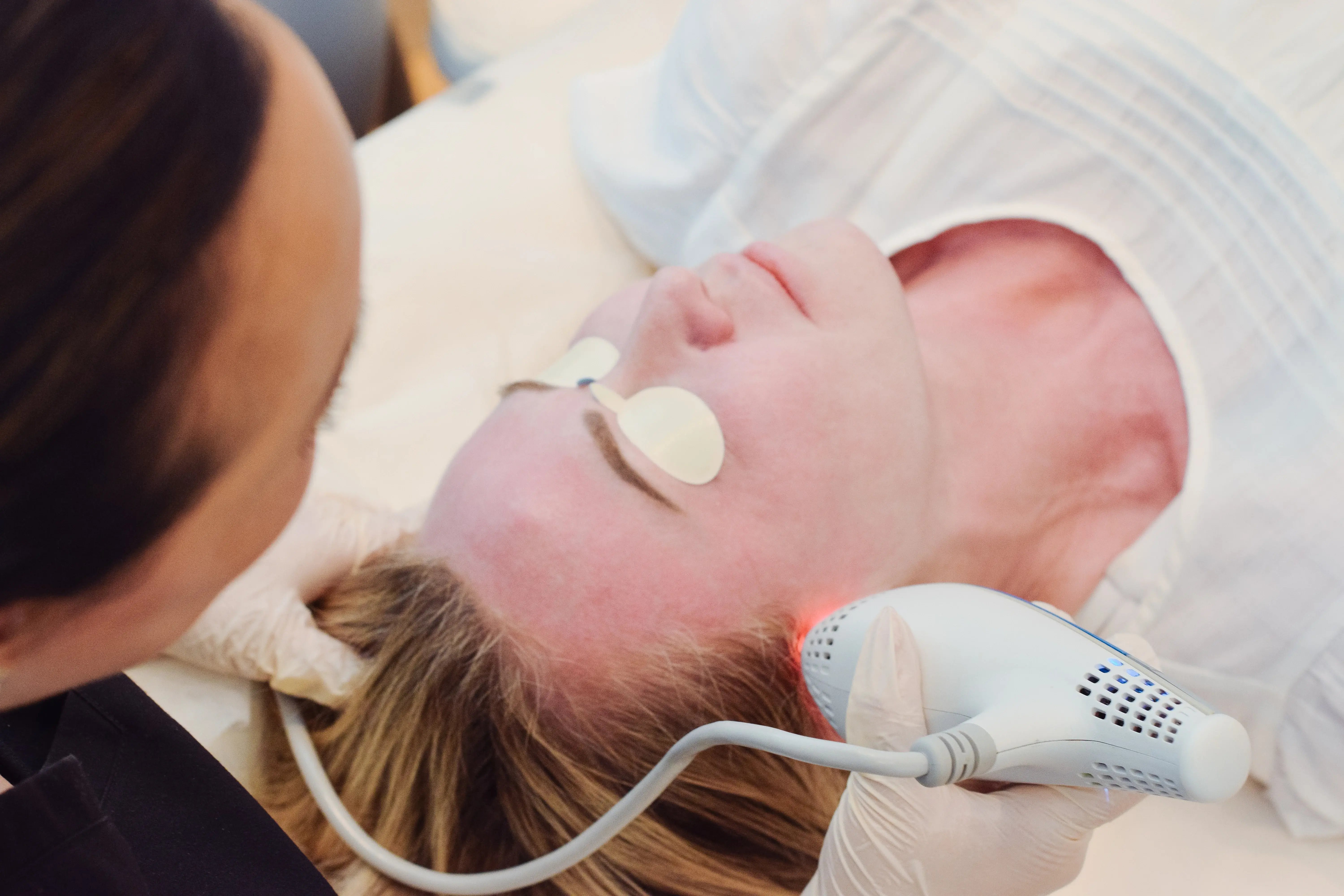 person-lying-on-treatment-bed-wearing-eye-shields-while-a-clinician-performs-a-facial-laser-procedure-on-their-cheek