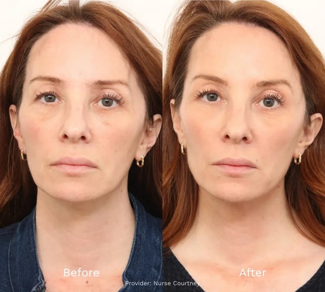 photo-side-by-side-woman-with-red-hair-before-and-after-neutral-expression-studio-lighting-earrings-visible-provider-text-nurse-courtney