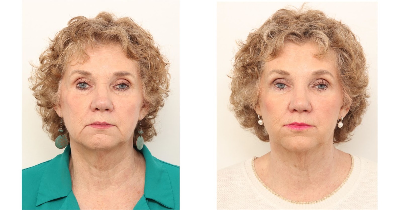 undefined-Feb-23-2026-03-08-45-3824-PM