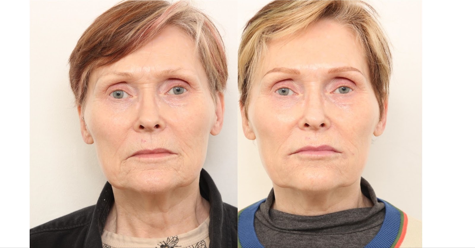 undefined-Nov-20-2025-05-17-53-4435-PM